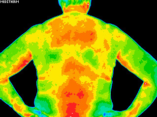 Underactive thymus gland